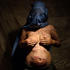 Life under the burqa