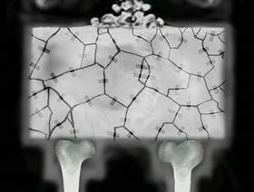 Screenshots from the 2003 United Plankton Pictures cartoon I Had an Accident