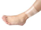 Oxygenating Bandage