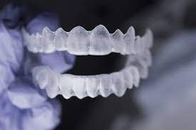 removable teeth aligners