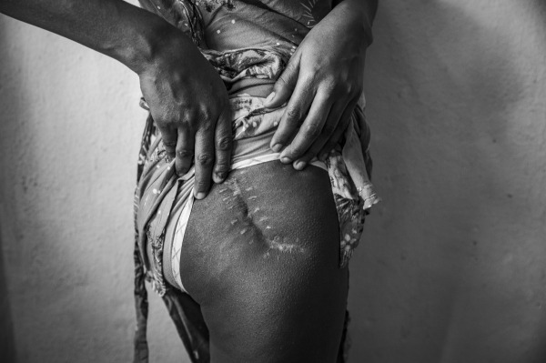 017_Africa_Long-Term Projects_Cinzia Canneri_Association Camille Lepage.jpg