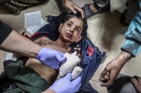 An injured boy is treated at al-Aqsa Hospital, Deir al-Balah, after an Israeli attack on al-Maghazi refugee camp. The population of the camp tripled in the first months of the war. Gaza, 1 January 2024