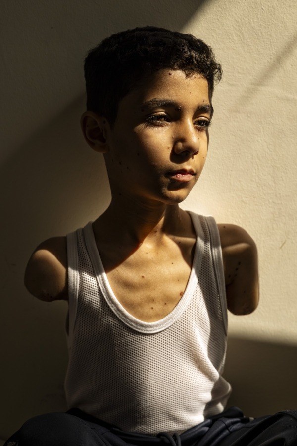 World Press Photo of the Year 2025 | Samar Abu Elouf - Mahmoud Ajjour, Aged Nine | World Press Photo