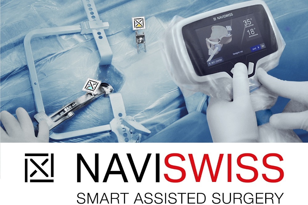 NAVISWISS Receives FDA Clearance for its miniature Hip Navigation