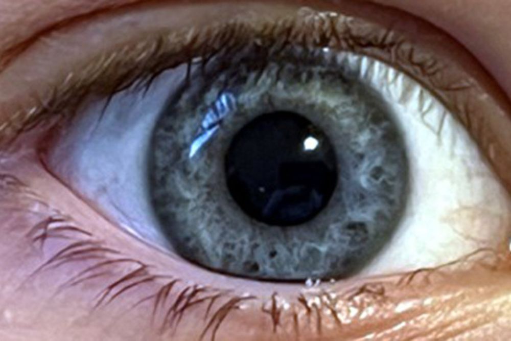 Eye-opening Origin Story: Scientists Trace Key Innovation in Our Camera ...