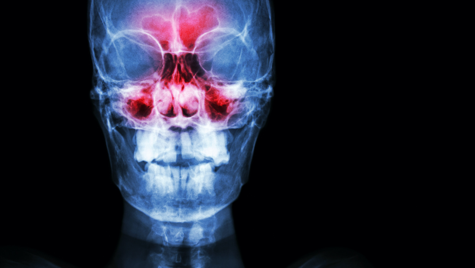Sinuses