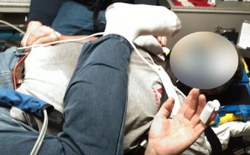 Man says he broke femur in icy Wheeling hotel parking lot - Vimarsana News