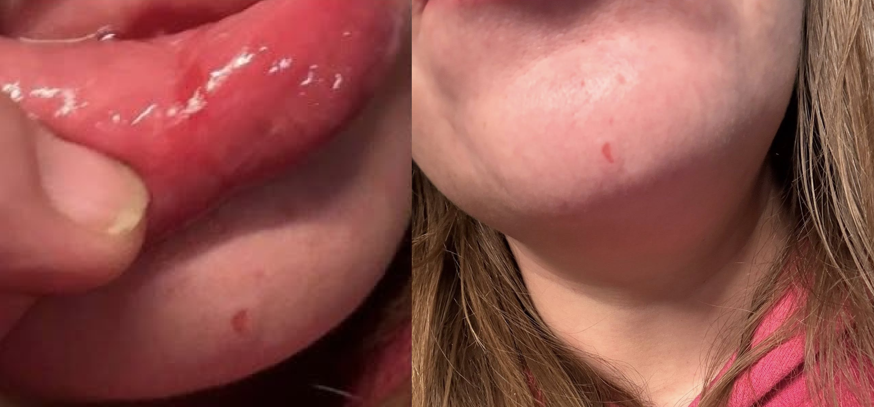 Emily Cahill holds a “We Love ICE” sign amid a leftist protest outside the Broadview ICE Processing Center, where she alleges she was assaulted and threatened.