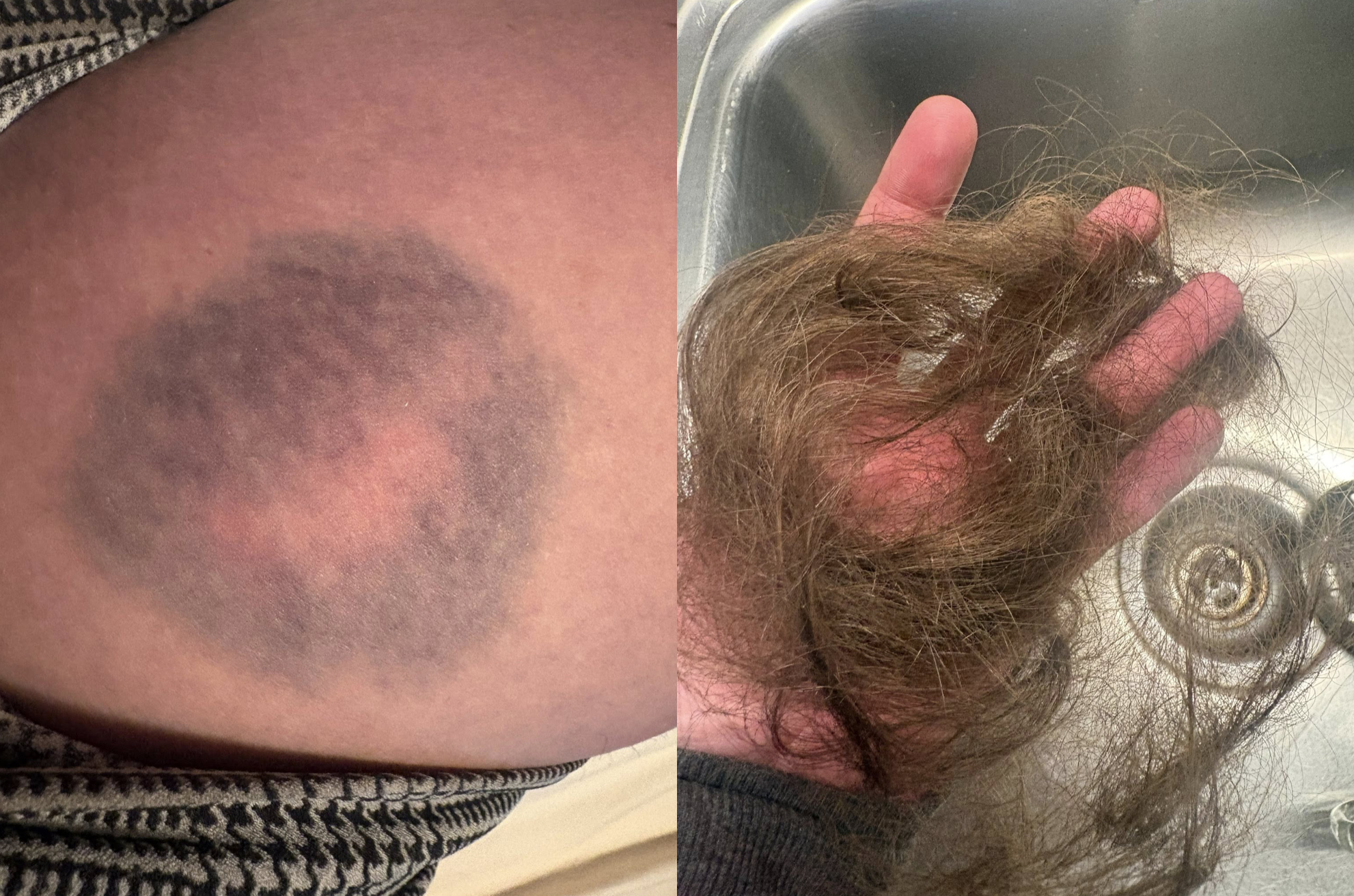 Emily Cahill holds a “We Love ICE” sign amid a leftist protest outside the Broadview ICE Processing Center, where she alleges she was assaulted and threatened.