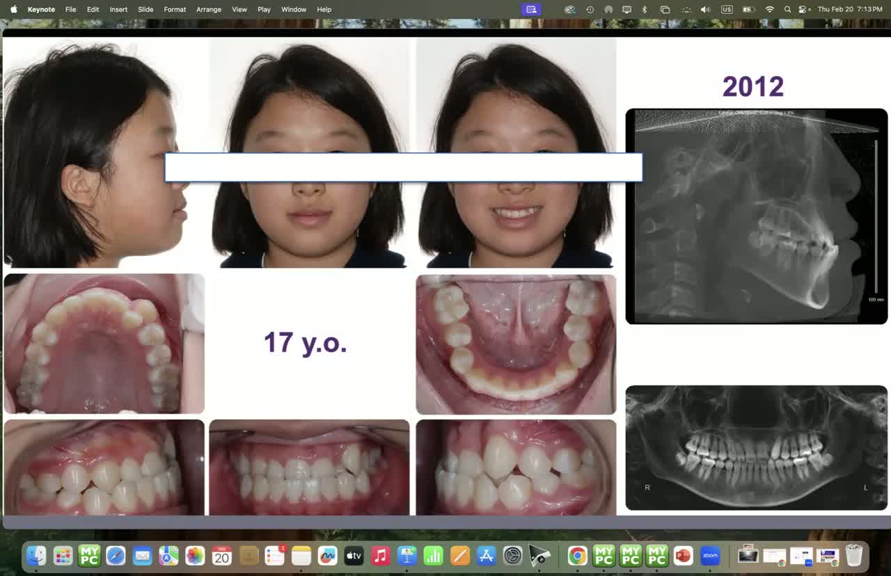 Airway Orthodontics with Dr. Ilya Lipkin
