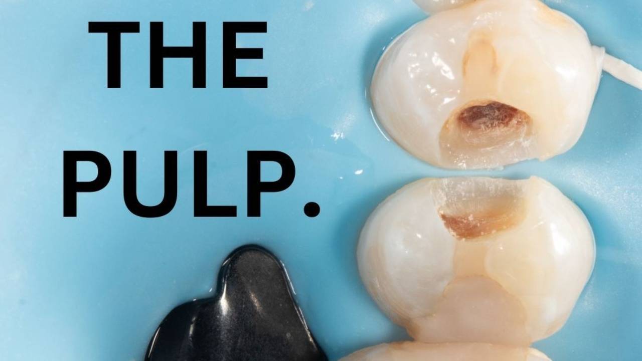 Minimally Invasive Caries Removal with Dr. Melissa Seibert