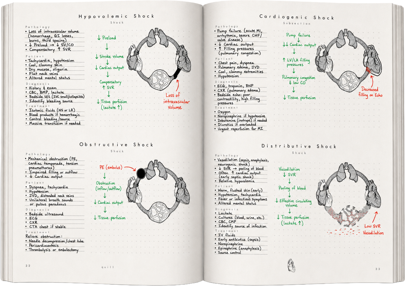 Notebook spread — the four types of shock with annotated circulation diagrams