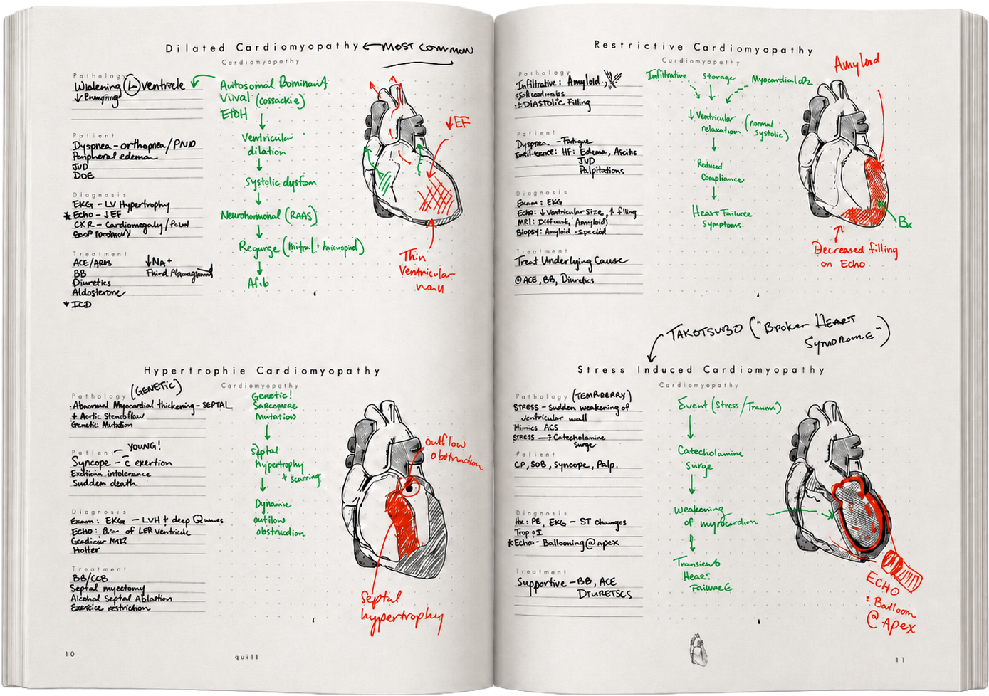 Notebook spread — cardiomyopathies with annotated heart illustrations