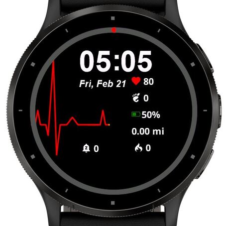 EKG