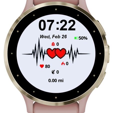 EKG