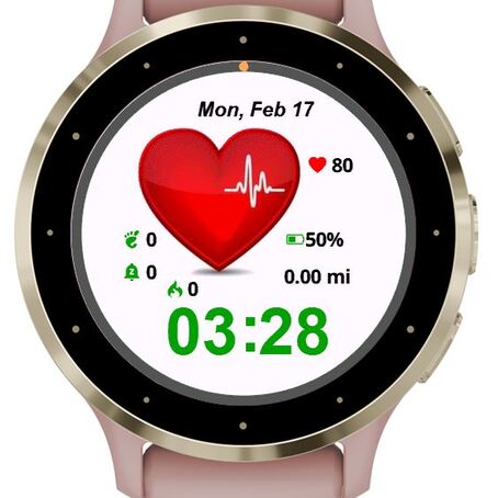 EKG