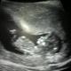 Fb_profile_picture.small