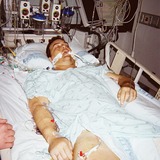 Dave%20post-surgery.medium