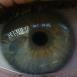Eye.medium