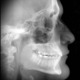 Xray.small