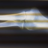 Elbow.medium