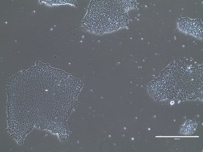 Feeder-free 시스템