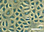 塞拉斯·德尔·埃伯里奥角膜