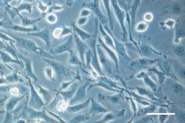 CHO cells grown in culture