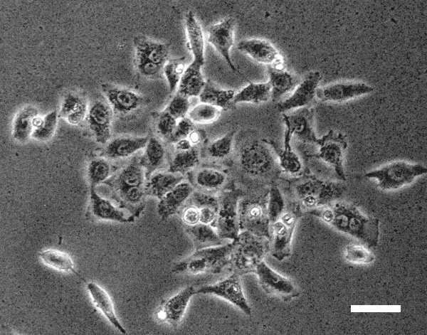 HEK293细胞生长在文化