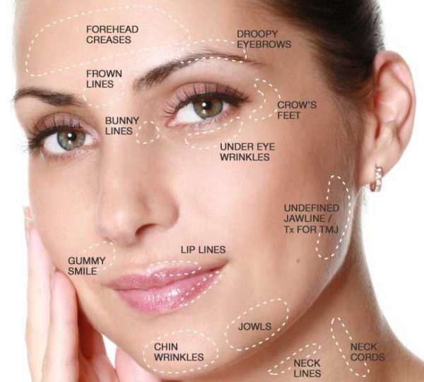 Botox Landmark Aesthetics MedSpa Laser Center