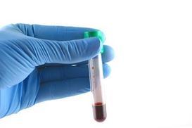 Gloved-hand-holding-test-tube-containing-blood