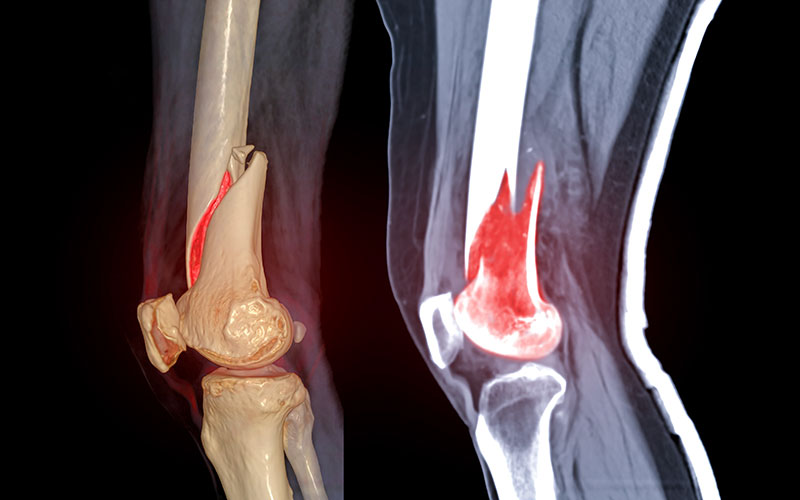 Medical Illustrations In Dallas TX