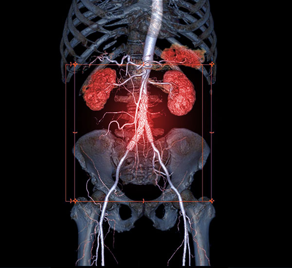 Medical Animation 3D In Dallas TX