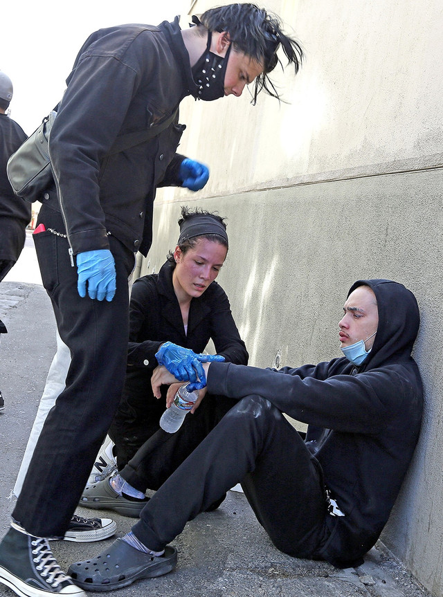 What to Do After an Injury: Hire a San Jose Personal Injury Lawyer