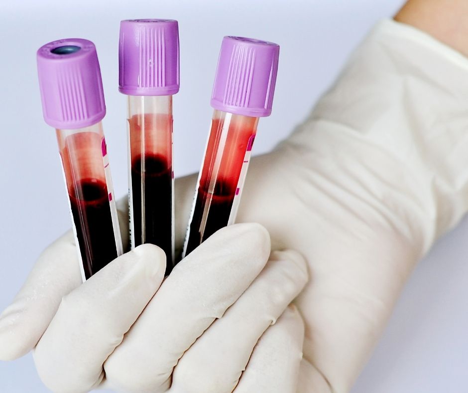 should i get life insurance with living benefits