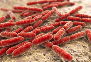 From the Mailbag: Probiotics vs. Poop, and Psoriasis Solutions