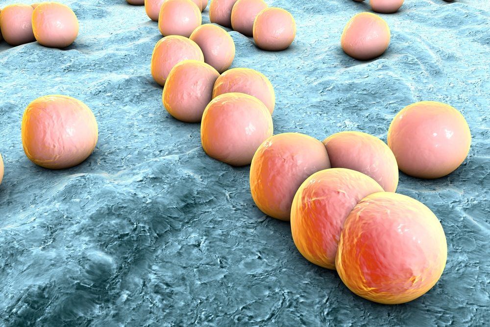 What causes cellulitis? | Life 360 Tips