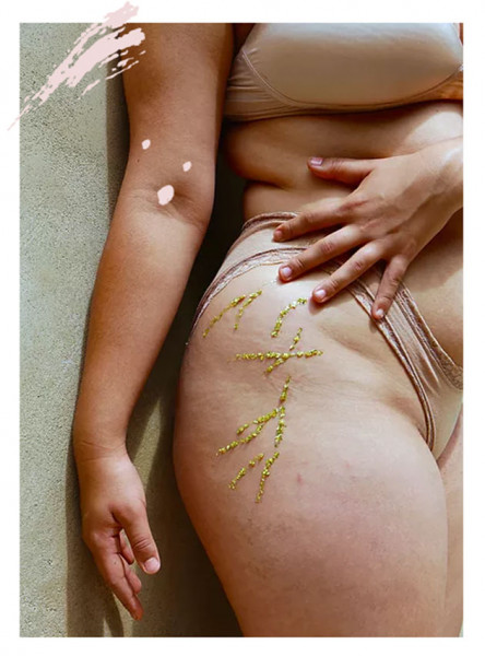 Então, pra reescever a narrativa e tirar essa vergonha do caminho, ela começou fotografando familiares e amigos, enfeitando suas estrias com glitter biodegradável e pedindo que respondessem perguntas pra entender melhor as lutas que enfrentaram em sua jornada por amor próprio e aceitação 210319-estria04