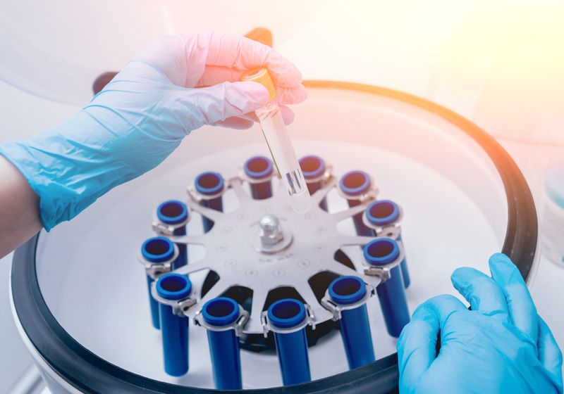 Ultracentrifuges Spinning Up Discovery Drug Discovery News