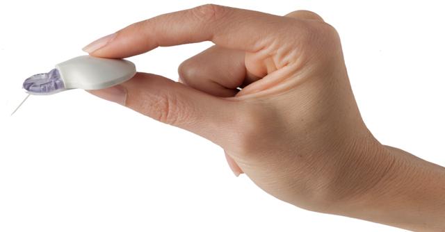 Optimizing Diabetes Management: 3 Layers Of CGM Alerts | The LOOP Blog