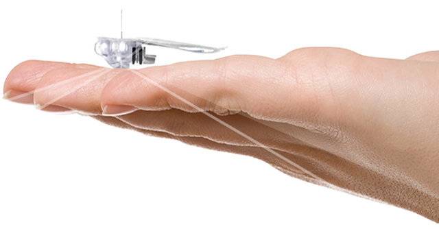 The Enlite Sensor: Interview With An Innovator | The LOOP Blog