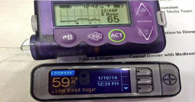 My Initial Thoughts On The MiniMed 530G With Enlite | The LOOP Blog
