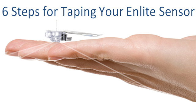 6 Steps For Taping Your Enlite Sensor | The LOOP Blog