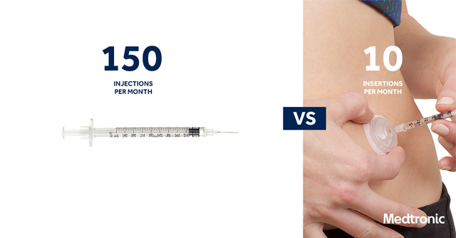 Introducing the i-Port Advance Injection Port | The LOOP Blog