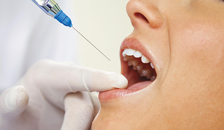 emergency tooth extraction