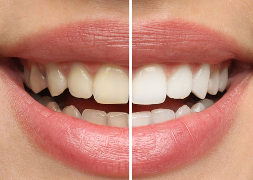 family smiles dental