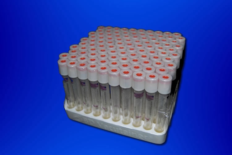 BD Vacutainer Tube PREP W/ WHITE TOP STERILE KE 9.0 Mg