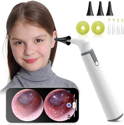 Anykit Wireless Otoscope Ear Camera with Dual View, 3.9mm 720PHD WiFi Ear Scope with Ear Wax Removal Tool for Kids and Adults & Pets, Compatible with Android and iPhone