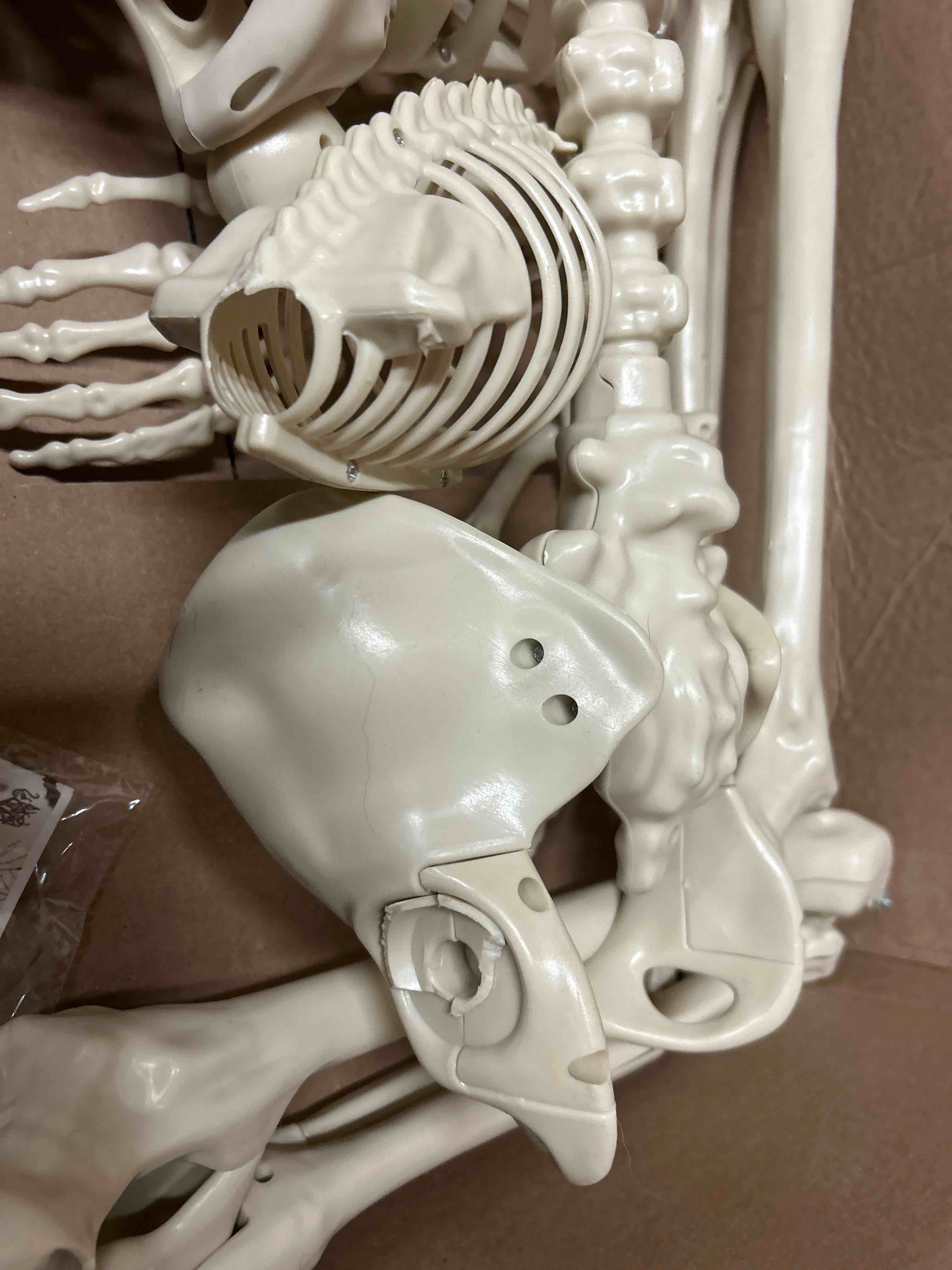 Condition photo showing Good Condition for Axis Scientific Life-Size Disarticulated Human Skeleton Model, 3 Part Human Skull, Articulated Bones, Hand and Foot, with Full-Color Detailed Product Manual