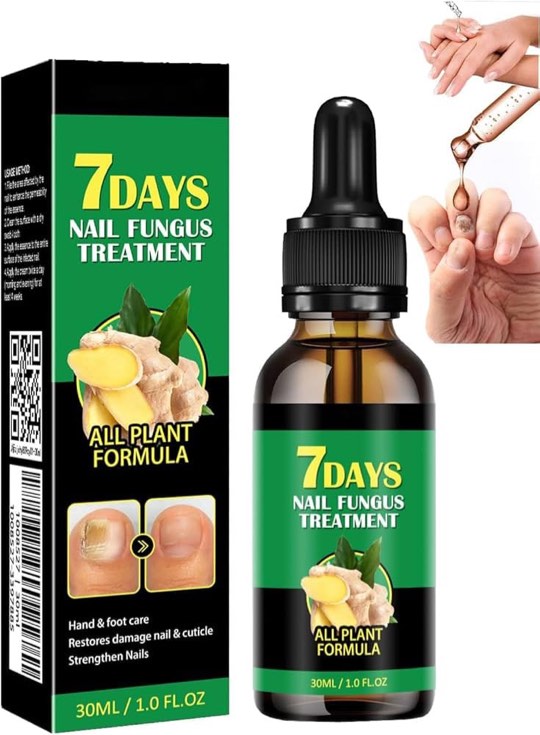 Ginger Nail Treatment, Ginger Cuticle Care Oil for Nails,Nail Treatment, Ginger Nail, Nail Nail Care,Nail Growth Serum,Ginger Nail Serum, Nail Nutrient Oil Strengthener Oil